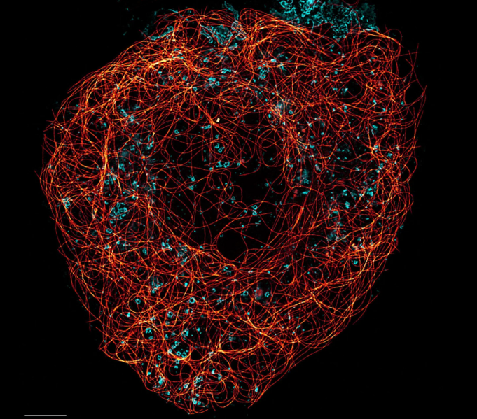 File:Actin STED.png